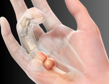 เช็กด่วน! คุณกำลังเสี่ยง โรคนิ้วล็อค อยู่หรือไม่?